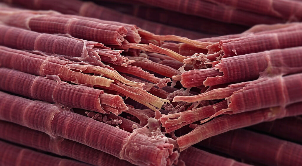 筋肉が分解されているイメージ